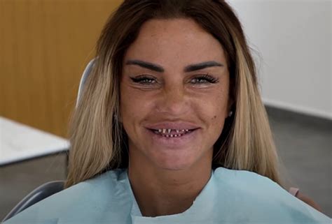 katie price teeth before and after|Katie Price’s Teeth: Dental Aesthetic Celebrity